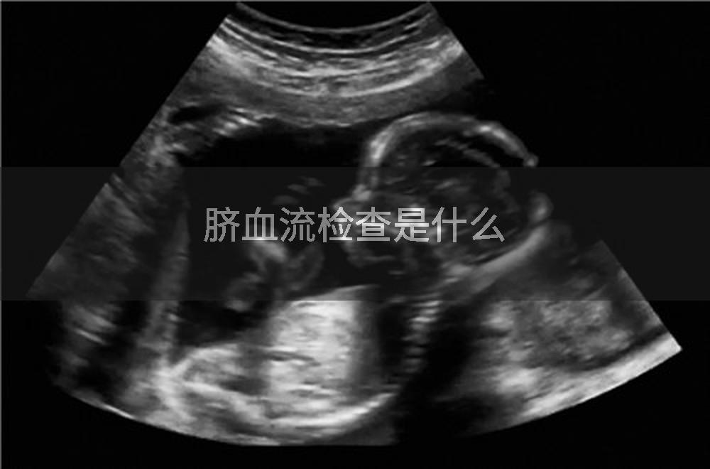 脐血流检查是什么