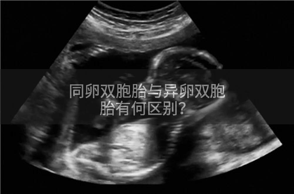 同卵双胞胎与异卵双胞胎有何区别？