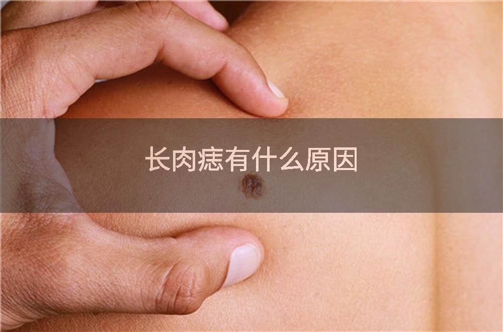 长肉痣有什么原因