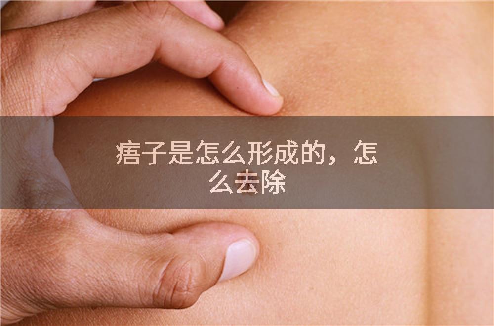痦子是怎么形成的，怎么去除