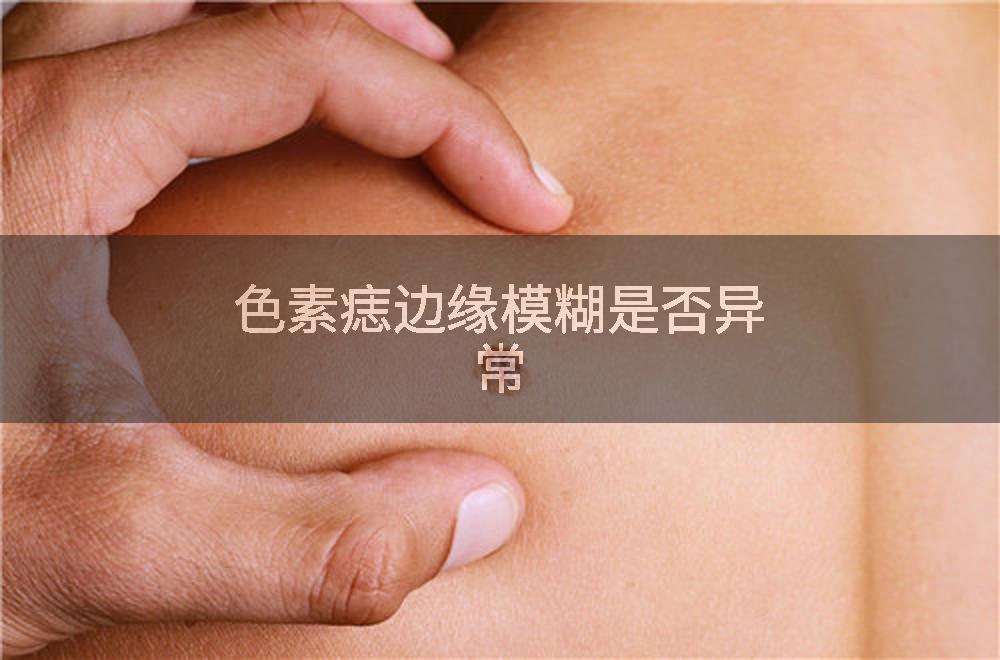 色素痣边缘模糊是否异常