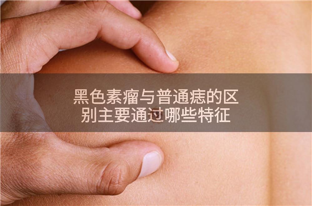 黑色素瘤与普通痣的区别主要通过哪些特征