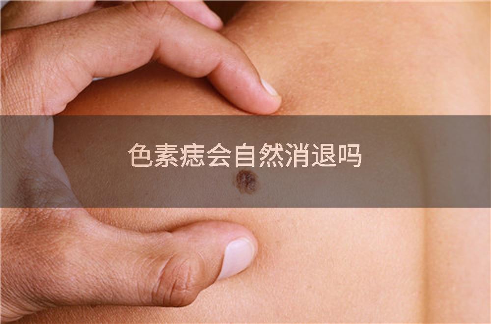 色素痣会自然消退吗