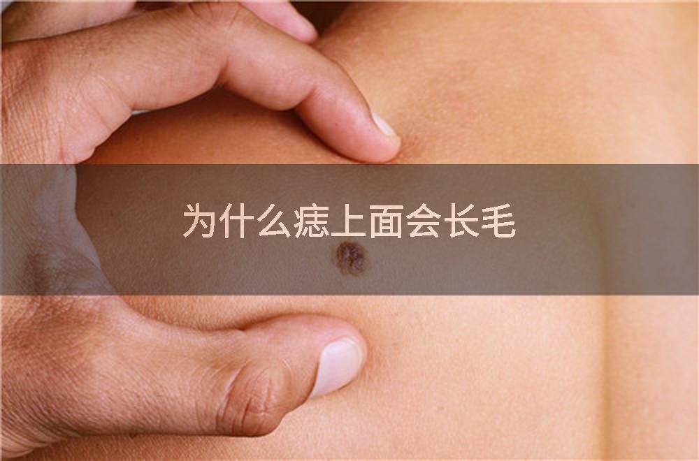 为什么痣上面会长毛