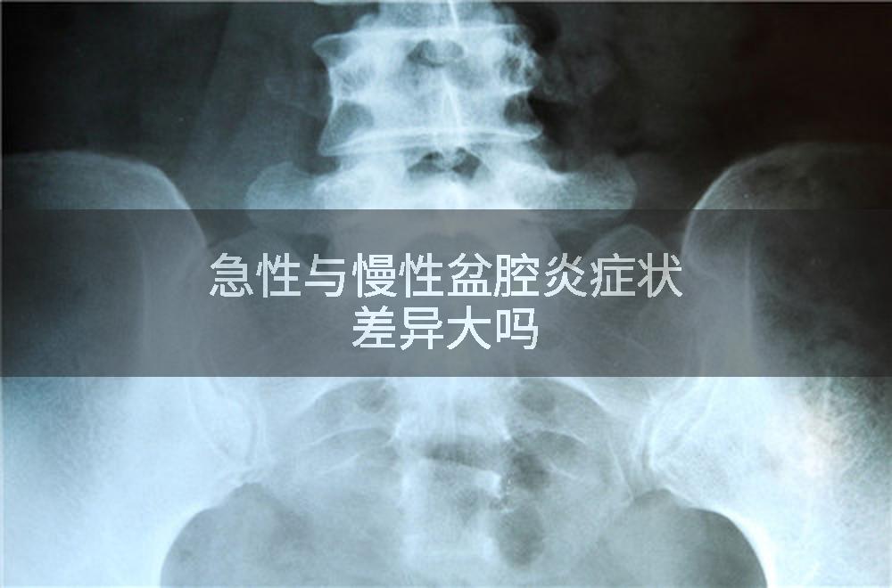 急性与慢性盆腔炎症状差异大吗