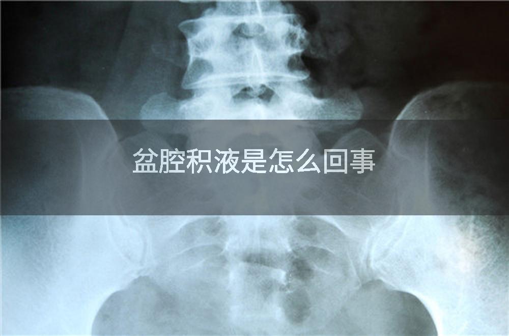 盆腔积液是怎么回事