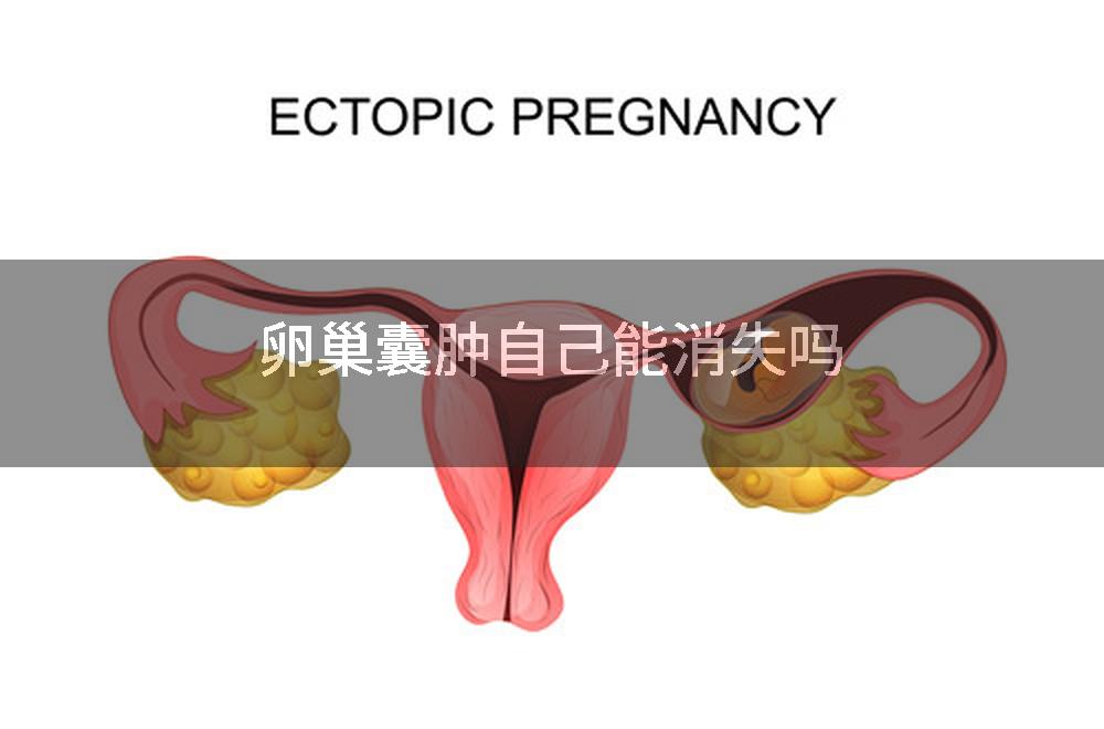 卵巢囊肿自己能消失吗