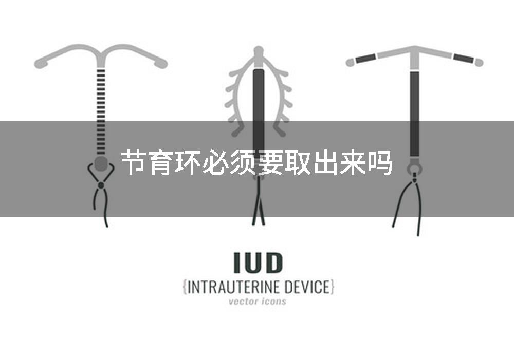 节育环必须要取出来吗