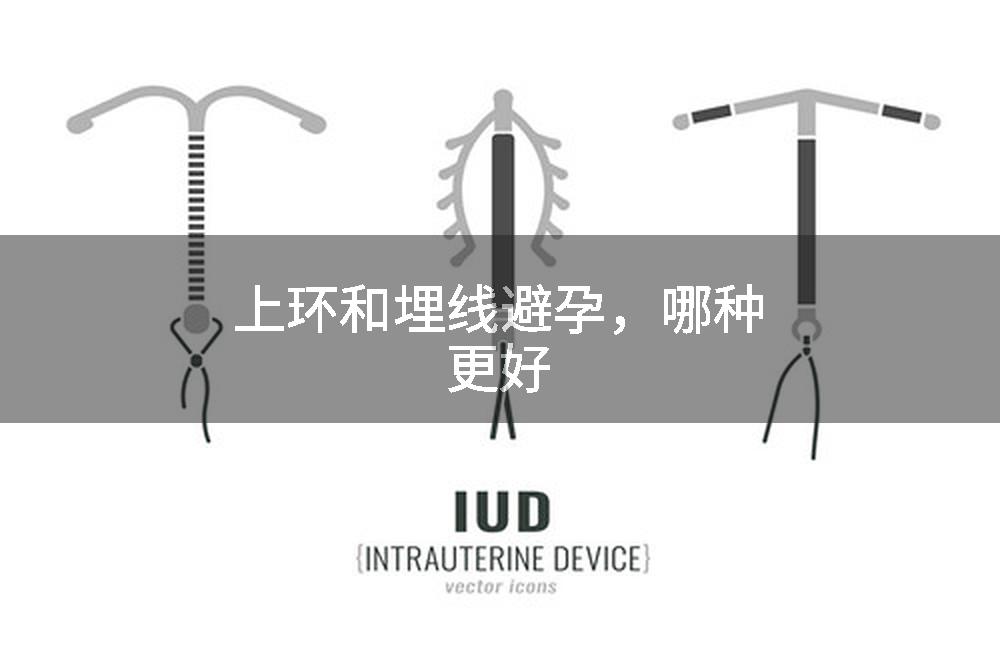 上环和埋线避孕，哪种更好