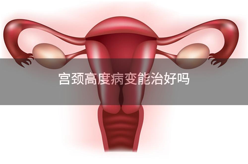 宫颈高度病变能治好吗