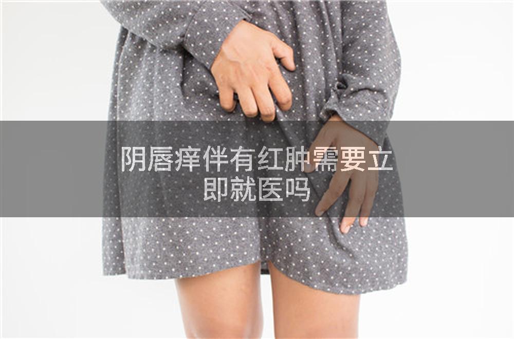 阴唇痒伴有红肿需要立即就医吗