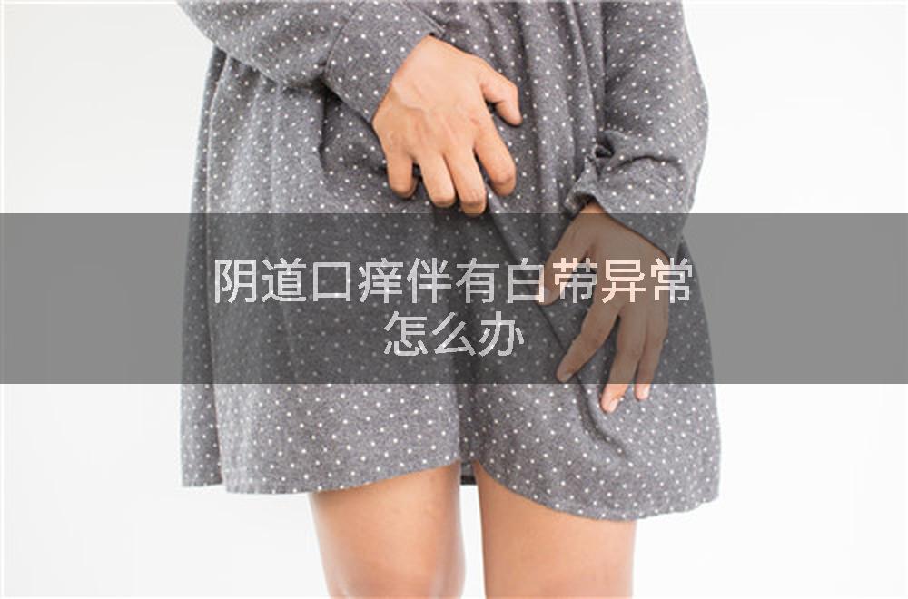 阴道口痒伴有白带异常怎么办