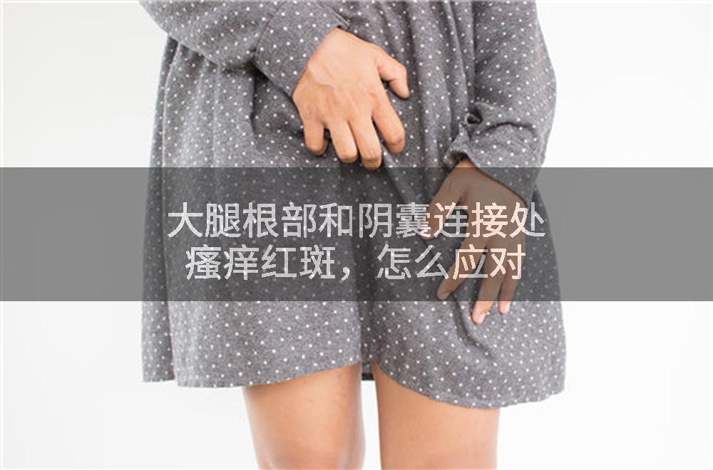 大腿根部和阴囊连接处瘙痒红斑，怎么应对