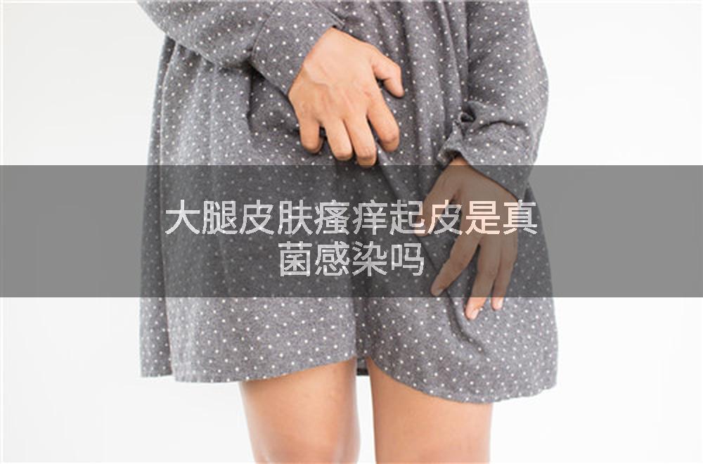 大腿皮肤瘙痒起皮是真菌感染吗