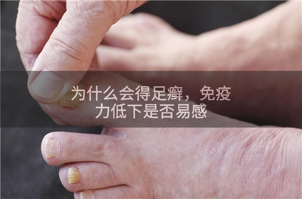 为什么会得足癣，免疫力低下是否易感