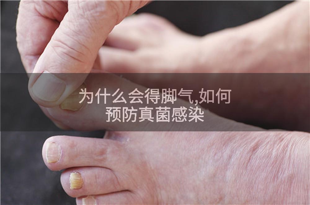 为什么会得脚气,如何预防真菌感染
