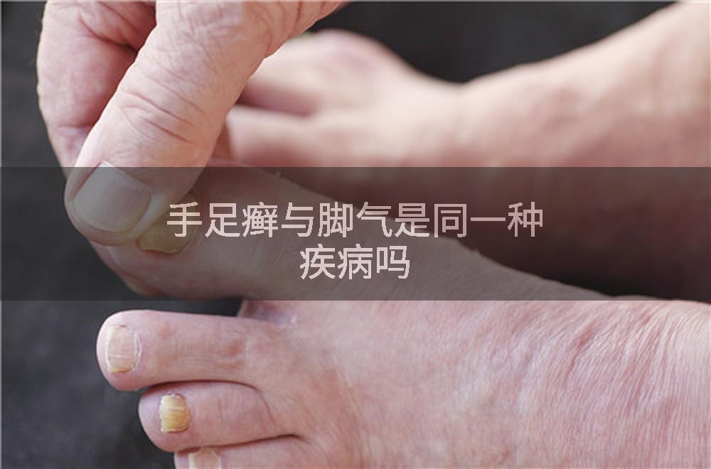 手足癣与脚气是同一种疾病吗