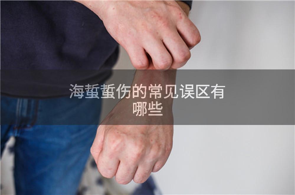 海蜇蜇伤的常见误区有哪些