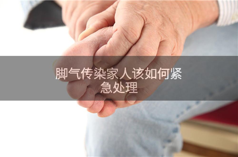 脚气传染家人该如何紧急处理