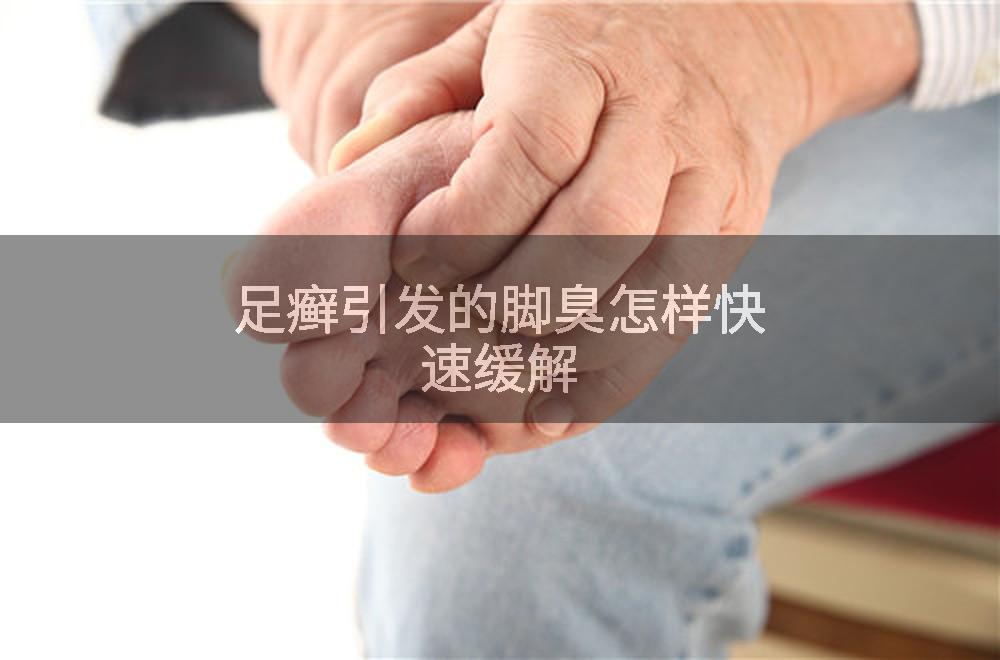 足癣引发的脚臭怎样快速缓解