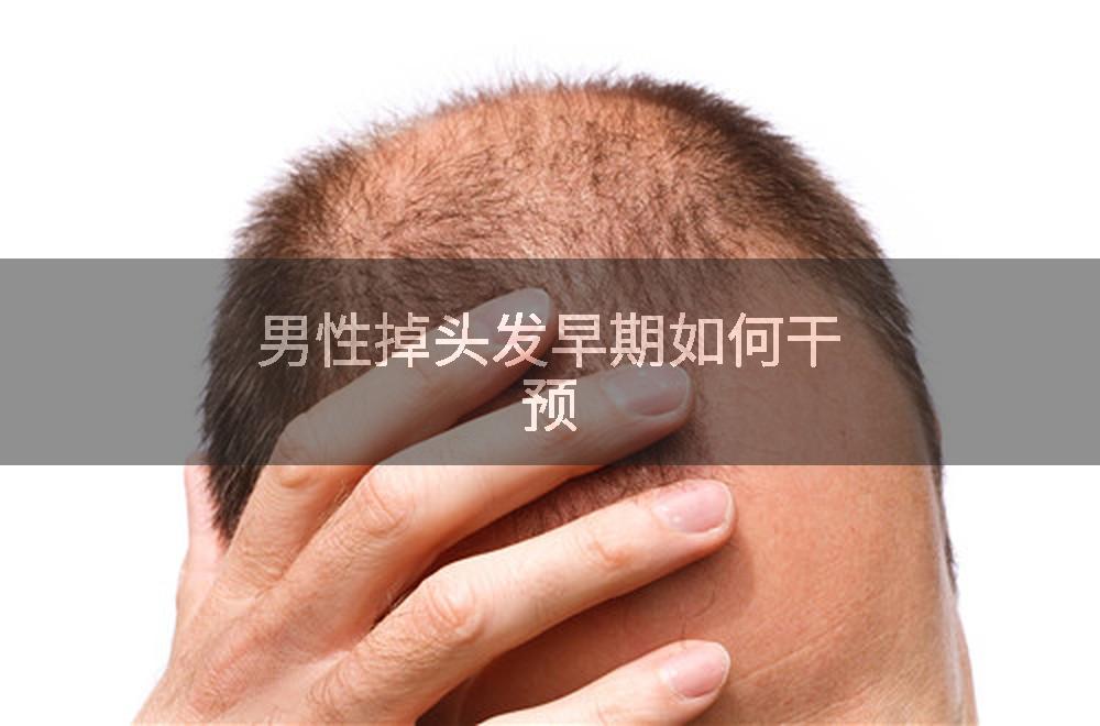 男性掉头发早期如何干预