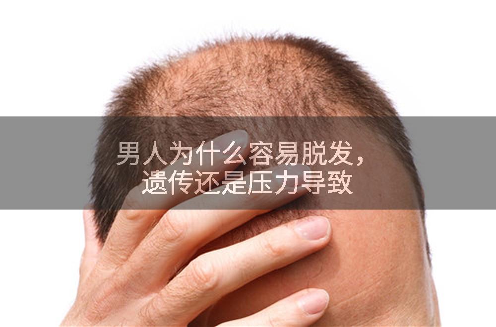 男人为什么容易脱发，遗传还是压力导致