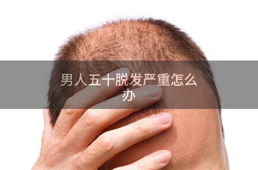男人五十脱发严重怎么办