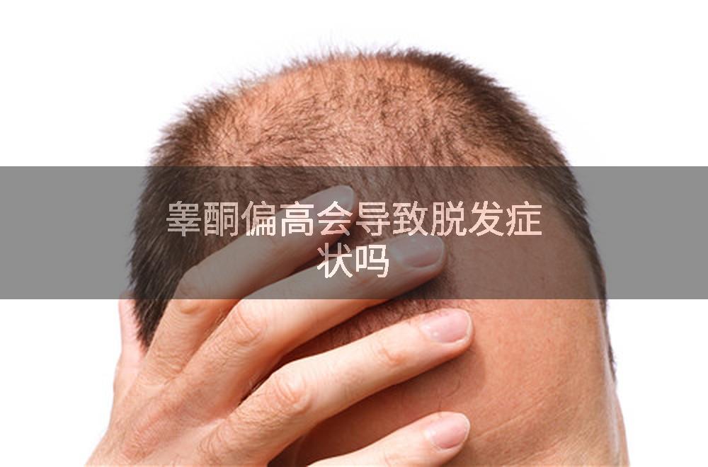 睾酮偏高会导致脱发症状吗