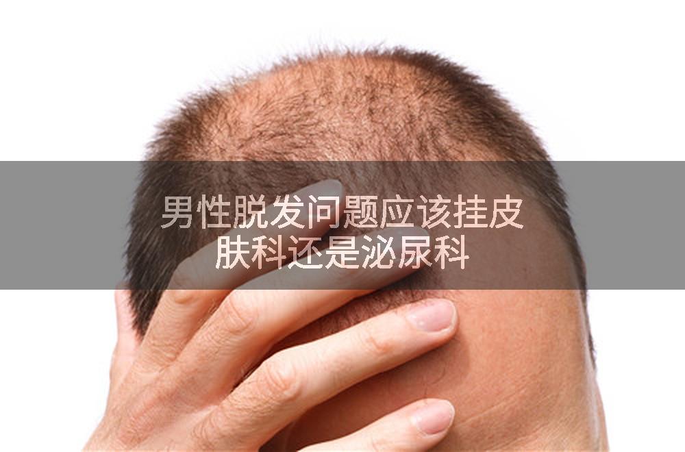 男性脱发问题应该挂皮肤科还是泌尿科