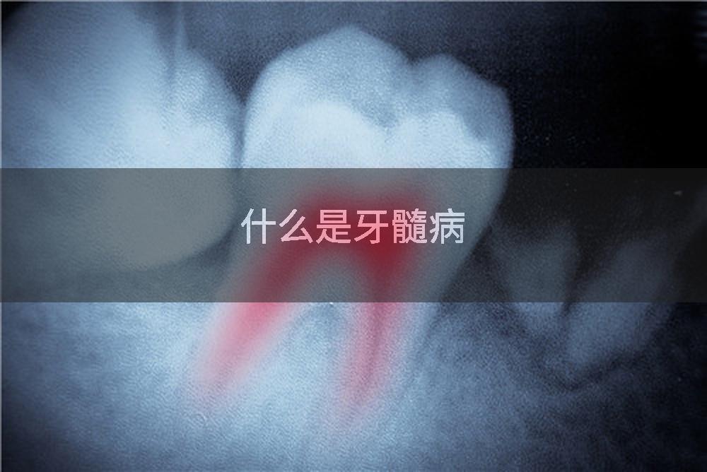 什么是牙髓病