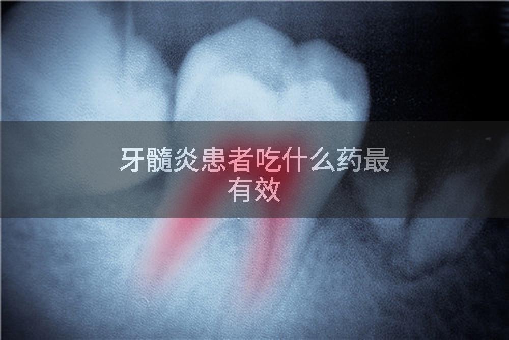 牙髓炎患者吃什么药最有效