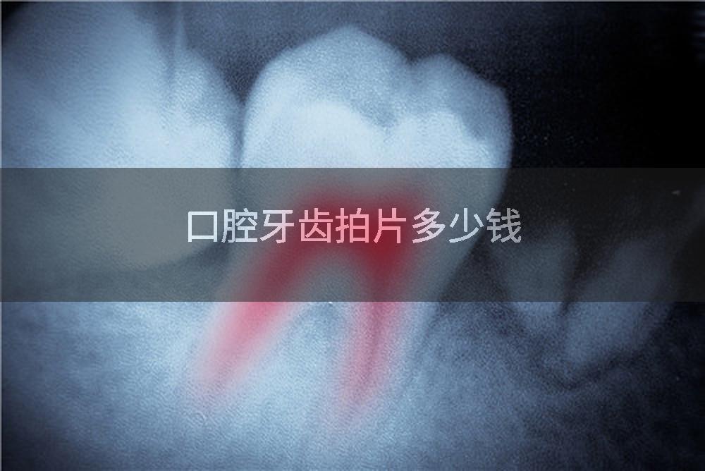 口腔牙齿拍片多少钱