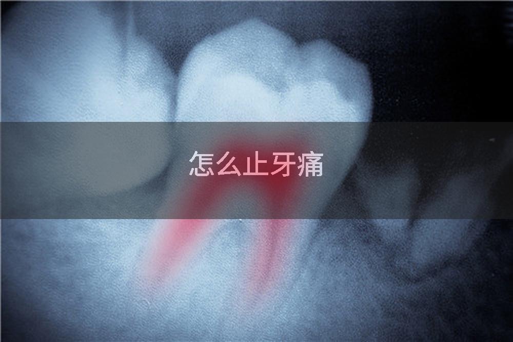 怎么止牙痛