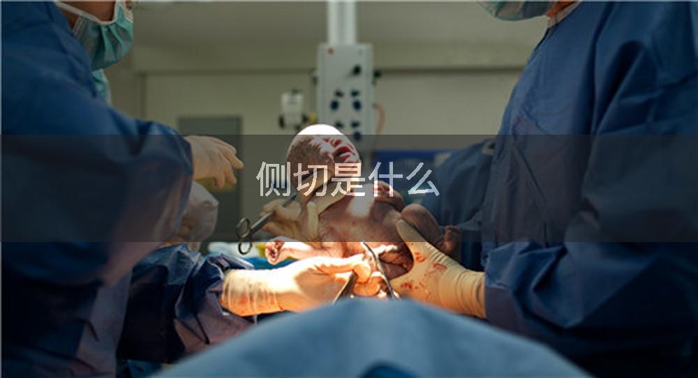 侧切是什么