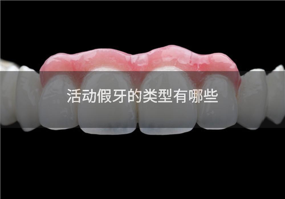 活动假牙的类型有哪些
