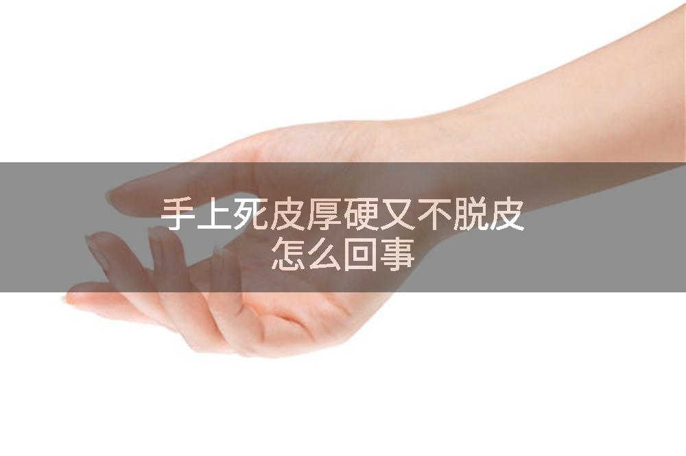 手上死皮厚硬又不脱皮怎么回事