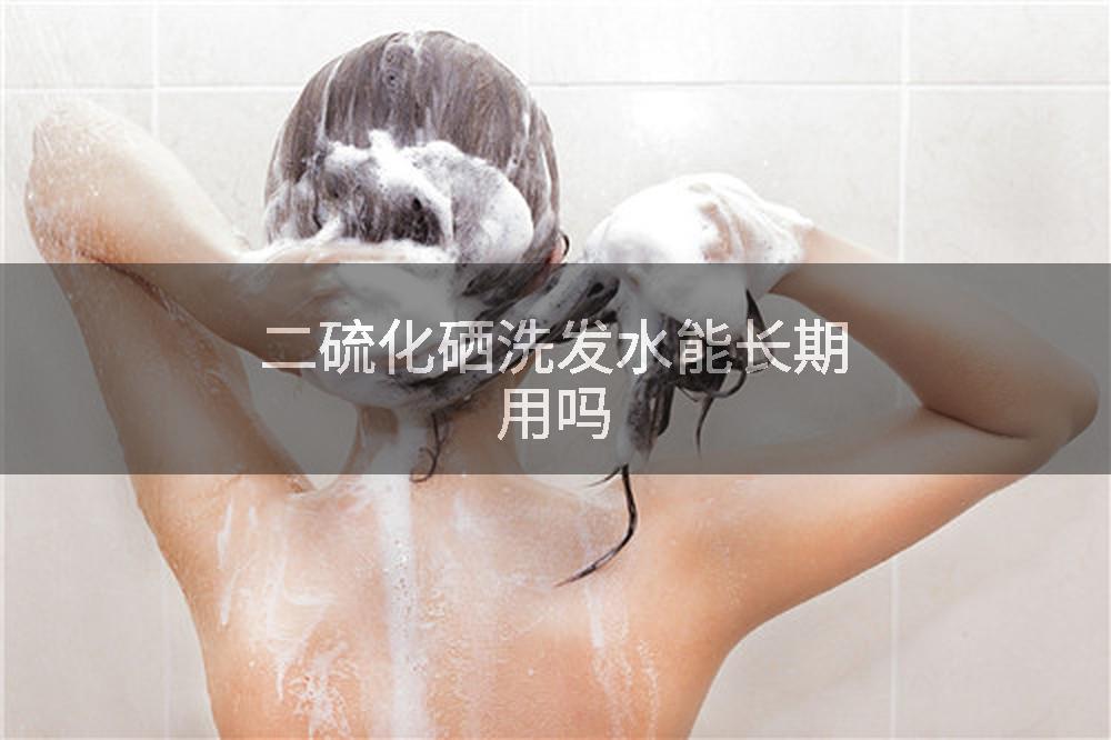 二硫化硒洗发水能长期用吗