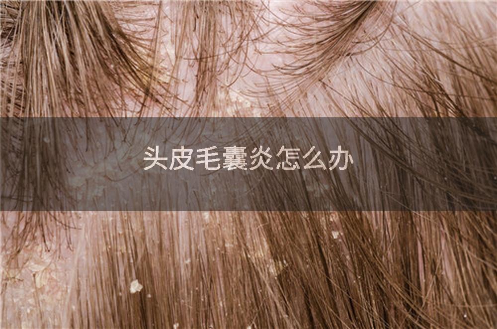头皮毛囊炎怎么办