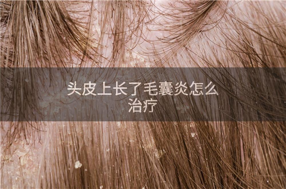 头皮上长了毛囊炎怎么治疗