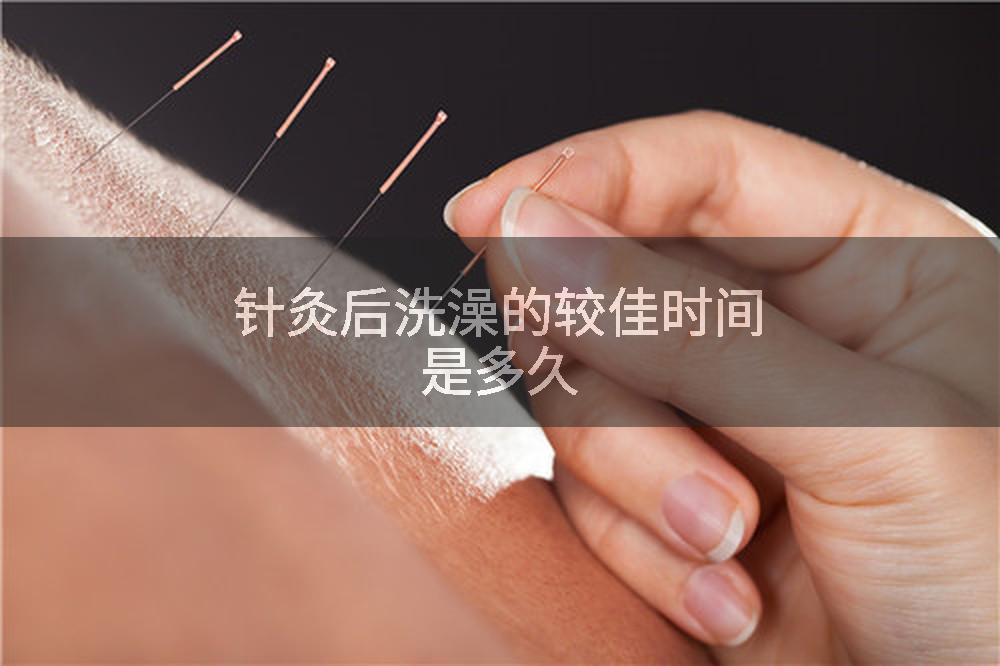 针灸后洗澡的较佳时间是多久