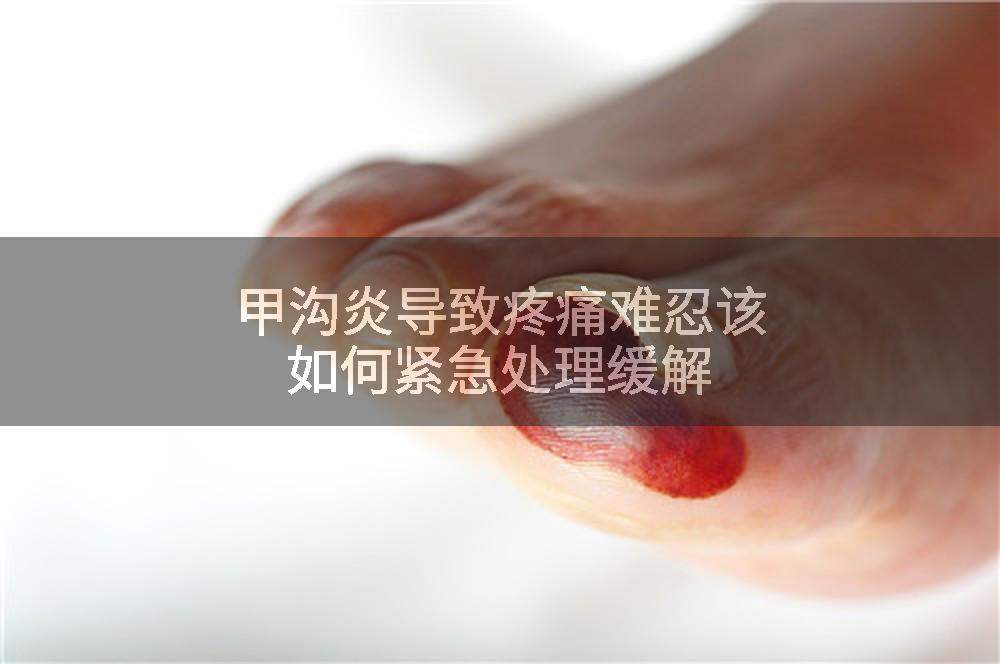 甲沟炎导致疼痛难忍该如何紧急处理缓解