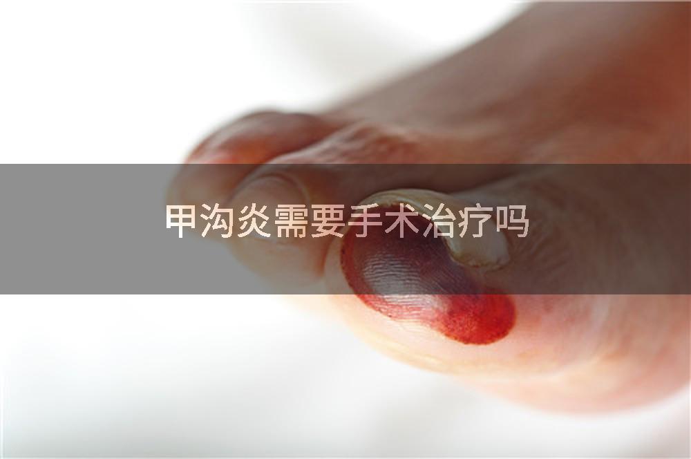 甲沟炎需要手术治疗吗