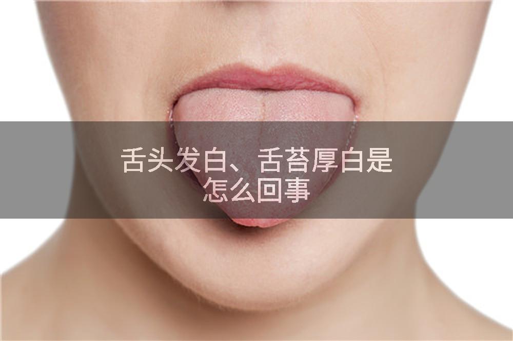舌头发白、舌苔厚白是怎么回事