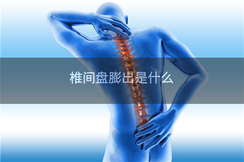 椎间盘膨出是什么