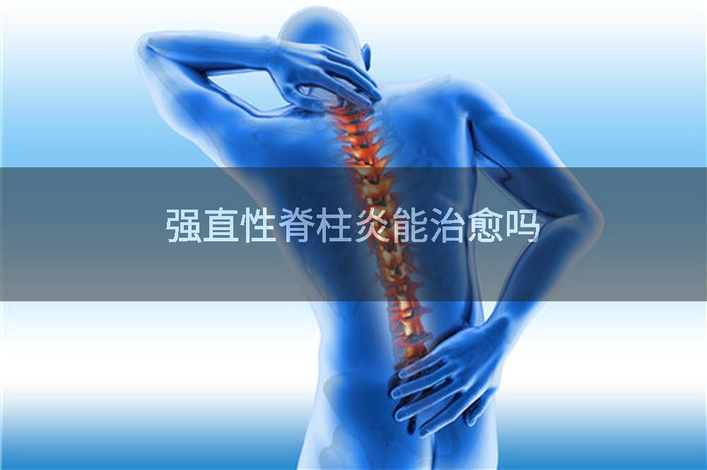 强直性脊柱炎能治愈吗