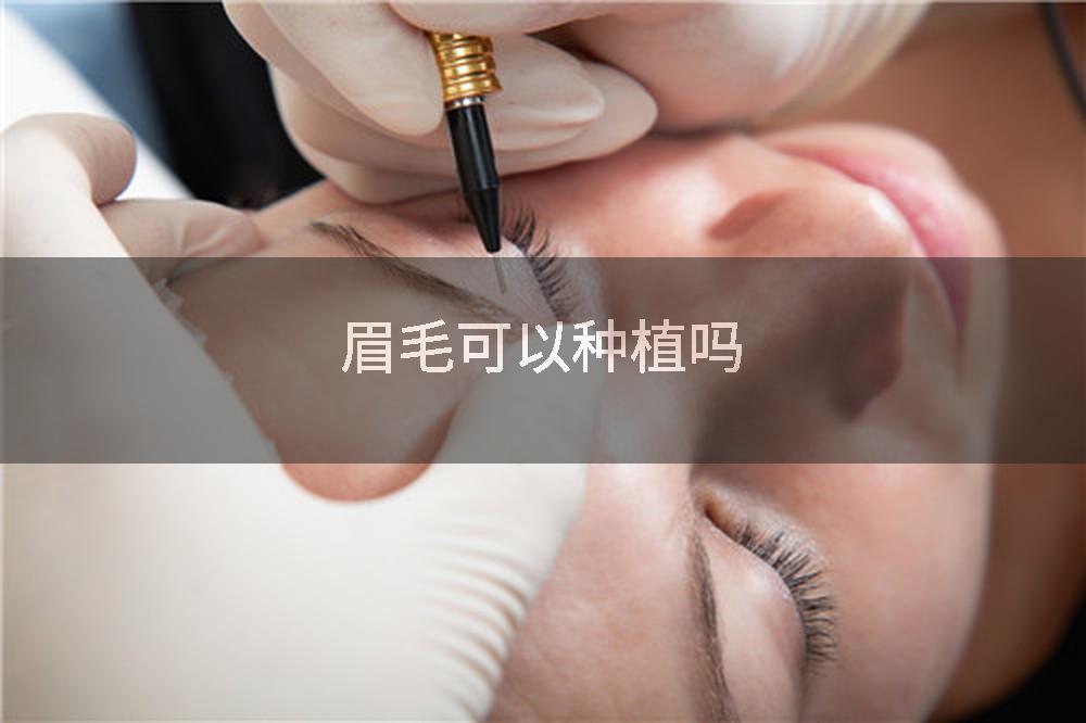 眉毛可以种植吗