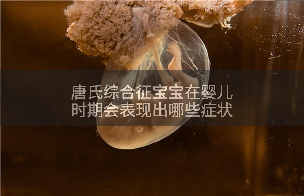 唐氏综合征宝宝在婴儿时期会表现出哪些症状