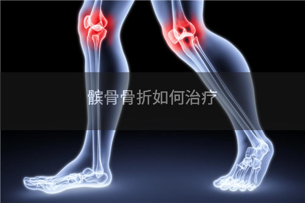 髌骨骨折如何治疗