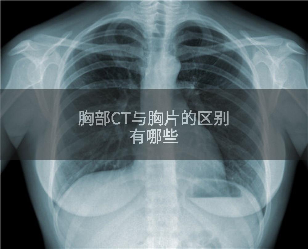 胸部CT与胸片的区别有哪些