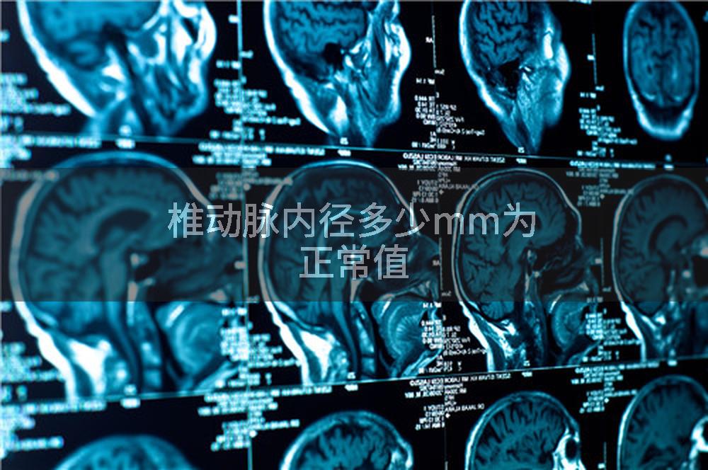 椎动脉内径多少mm为正常值